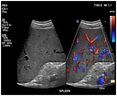 Ultrasound of the Abdomen3 Ultrasound of the Abdomen3